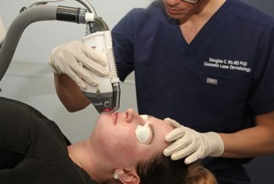 Skin Resurfacing Laser (Non-Ablative)